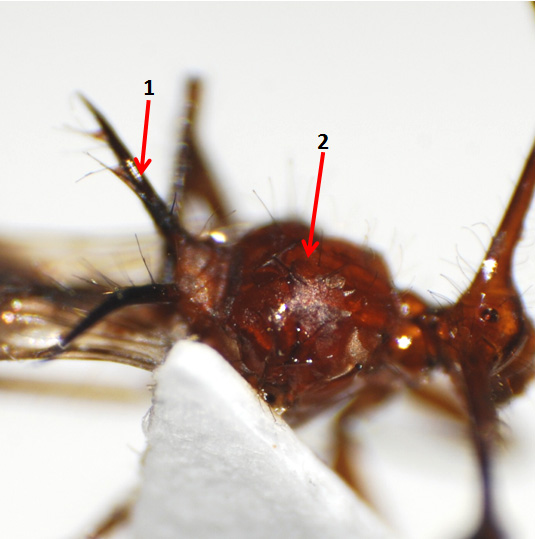 thorax2.jpg thorax2.jpg